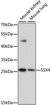 SSX4 Polyclonal Antibody