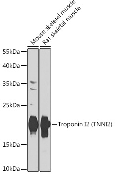 Troponin I2 (TNNI2) Polyclonal Antibody
