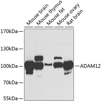 ADAM12 Polyclonal Antibody&nbsp;<img src="images/icon_newarrival.gif" alt="new" border="0">