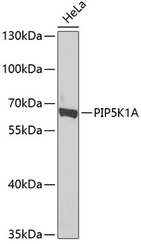 PIP5K1A Polyclonal Antibody