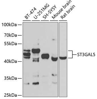 ST3GAL5 Polyclonal Antibody
