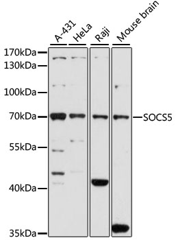 SOCS5 Polyclonal Antibody