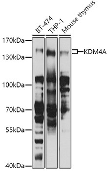KDM4A Polyclonal Antibody