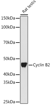 Cyclin B2 Monoclonal Antibody [1L9B9]