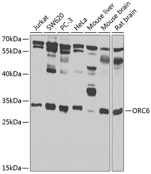 ORC6 Polyclonal Antibody