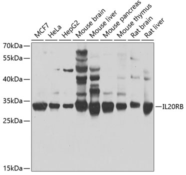 IL20RB Polyclonal Antibody