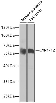 CYP4F12 Polyclonal Antibody