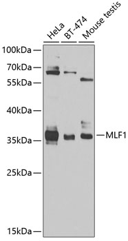 MLF1 Polyclonal Antibody