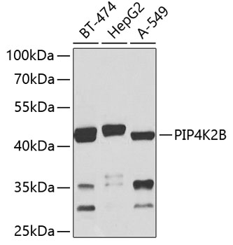 PIP4K2B Polyclonal Antibody