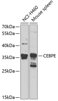 CEBPE Polyclonal Antibody