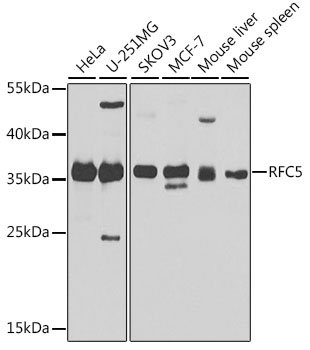 RFC5 Polyclonal Antibody