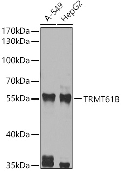 TRMT61B Polyclonal Antibody