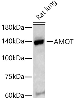 AMOT Polyclonal Antibody