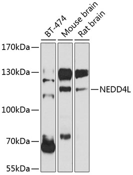 NEDD4L Polyclonal Antibody