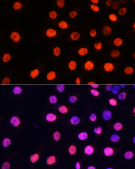 MonoMethyl-NONO/p54nrb-R357/R365 Polyclonal Antibody