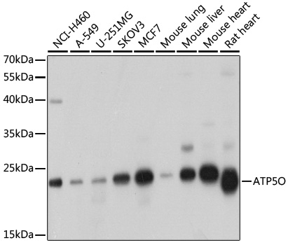 ATP5O Polyclonal Antibody