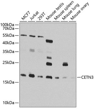 CETN3 Polyclonal Antibody
