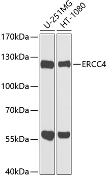 ERCC4 Polyclonal Antibody