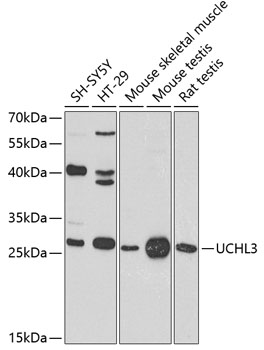 UCHL3 Polyclonal Antibody