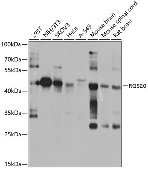 RGS20 Polyclonal Antibody