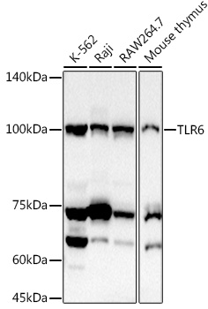 TLR6 Polyclonal Antibody