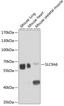 SLC9A6 Polyclonal Antibody