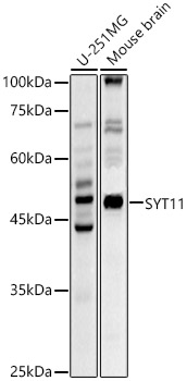 SYT11 Polyclonal Antibody