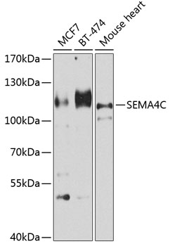 SEMA4C Polyclonal Antibody