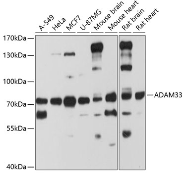 ADAM33 Polyclonal Antibody&nbsp;<img src="images/icon_newarrival.gif" alt="new" border="0">