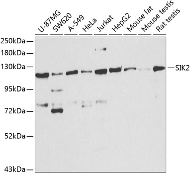 SIK2 Polyclonal Antibody