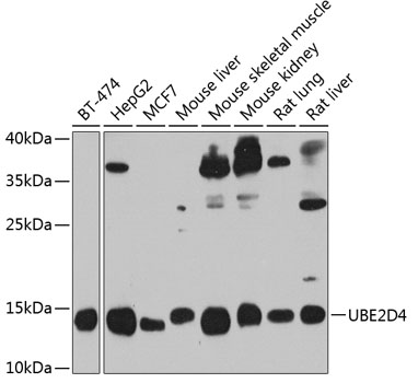 UBE2D4 Polyclonal Antibody