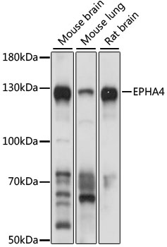 EPHA4 Polyclonal Antibody