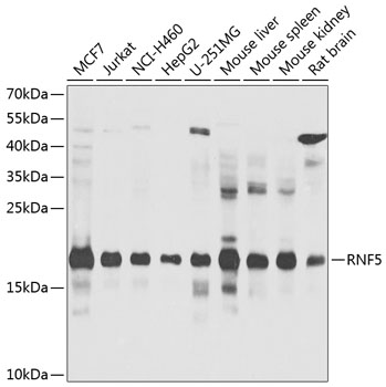 RNF5 Polyclonal Antibody