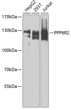 PPP6R2 Polyclonal Antibody