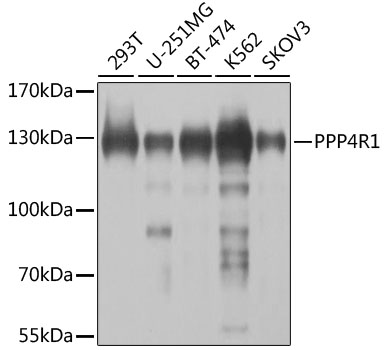 PPP4R1 Polyclonal Antibody