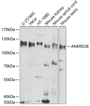 ANKRD28 Polyclonal Antibody