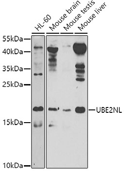 UBE2NL Polyclonal Antibody
