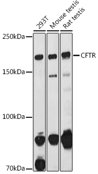 CFTR Polyclonal Antibody