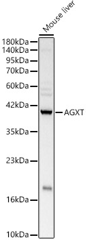 AGXT Polyclonal Antibody&nbsp;<img src="images/icon_newarrival.gif" alt="new" border="0">