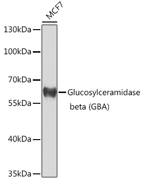 Glucosylceramidase beta (GBA) Polyclonal Antibody