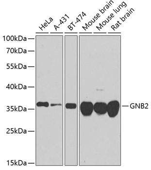 GNB2 Polyclonal Antibody