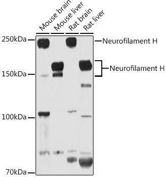 Neurofilament H Polyclonal Antibody