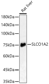 SLCO1A2 Polyclonal Antibody