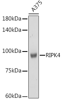 RIPK4 Polyclonal Antibody