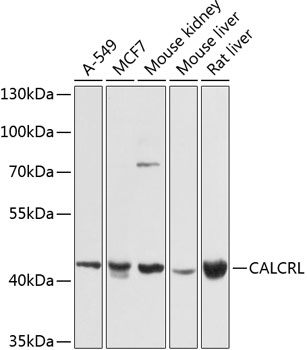 CALCRL Polyclonal Antibody