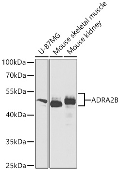 ADRA2B Polyclonal Antibody&nbsp;<img src="images/icon_newarrival.gif" alt="new" border="0">