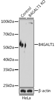 B4GALT1 Polyclonal Antibody
