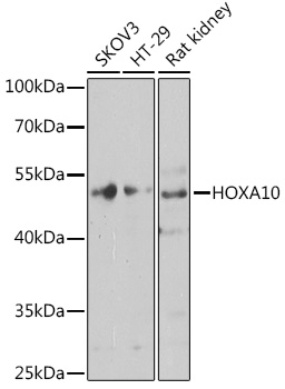 HOXA10 Polyclonal Antibody