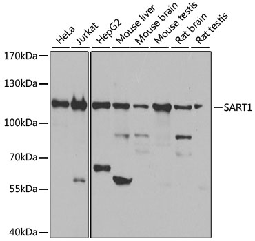 SART1 Polyclonal Antibody