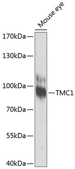 TMC1 Polyclonal Antibody